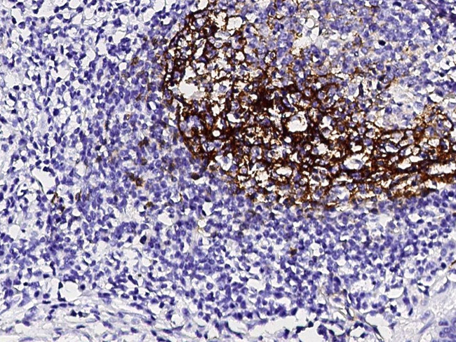 CD23 Antibody in Immunohistochemistry (Paraffin) (IHC (P))