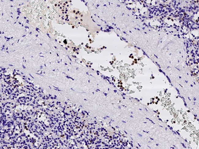 FCN1 Antibody in Immunohistochemistry (Paraffin) (IHC (P))