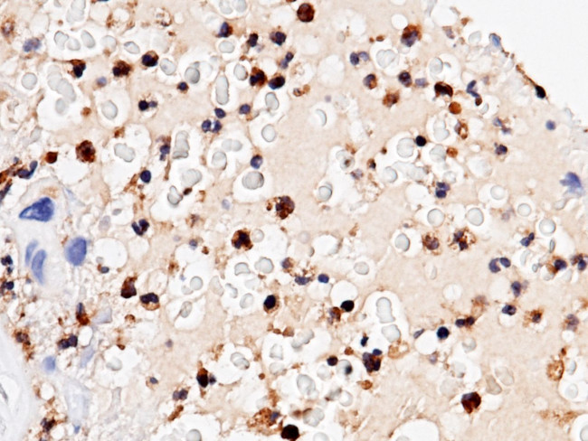 FCN1 Antibody in Immunohistochemistry (Paraffin) (IHC (P))