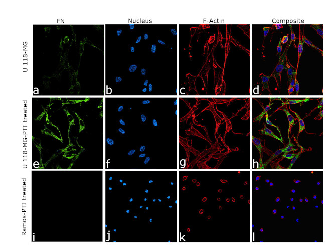 Fibronectin Antibody in Immunocytochemistry (ICC/IF)