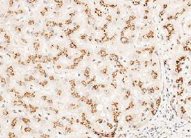 GOLPH2 Antibody in Immunohistochemistry (Paraffin) (IHC (P))