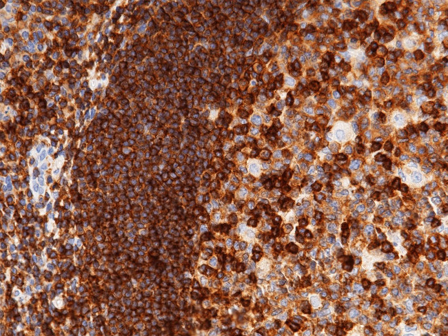 ICAM-3 Antibody in Immunohistochemistry (Paraffin) (IHC (P))