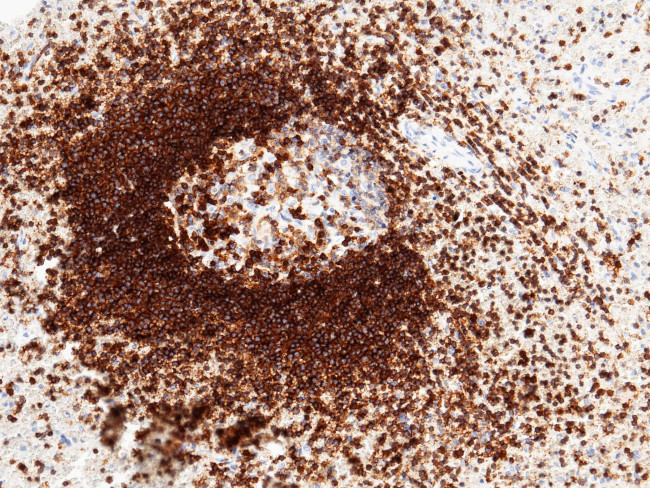 ICAM-3 Antibody in Immunohistochemistry (Paraffin) (IHC (P))