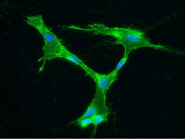 ITGA5/ITGB1 Antibody in Immunocytochemistry (ICC/IF)