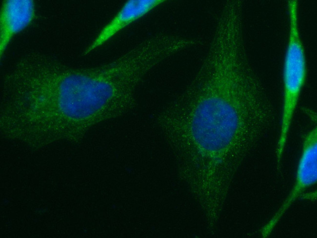 IVD Antibody in Immunocytochemistry (ICC/IF)