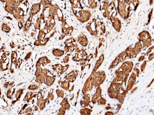 PSA Antibody in Immunohistochemistry (Paraffin) (IHC (P))