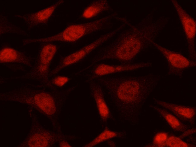 MAX Antibody in Immunocytochemistry (ICC/IF)