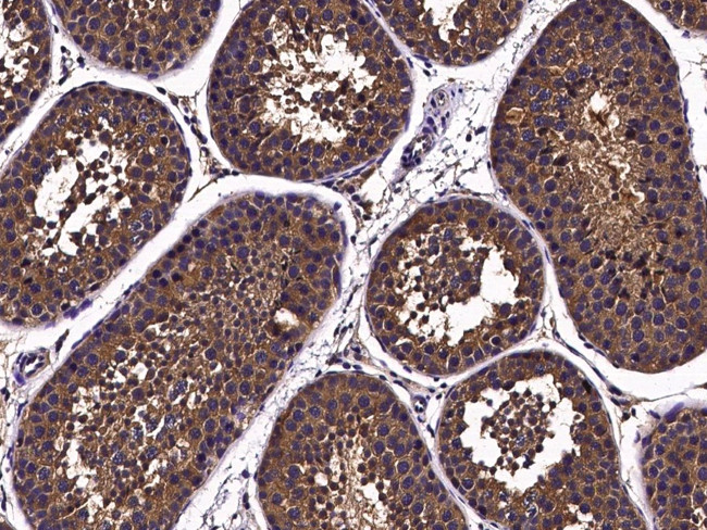 Nectin 3 Antibody in Immunohistochemistry (Paraffin) (IHC (P))
