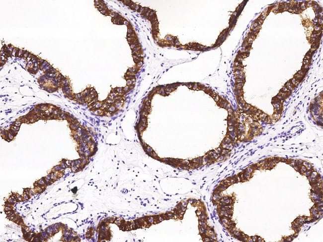 NPC2 Antibody in Immunohistochemistry (Paraffin) (IHC (P))