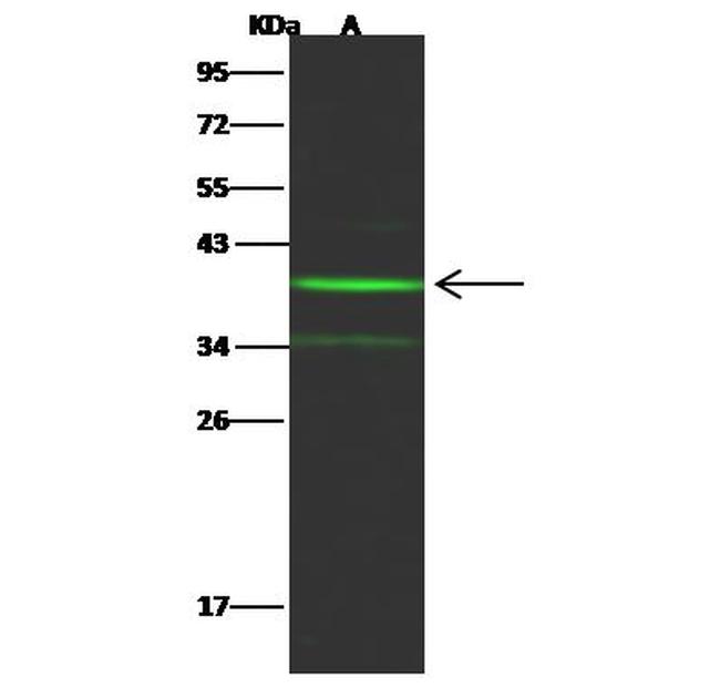 NT5C3A Antibody in Western Blot (WB)