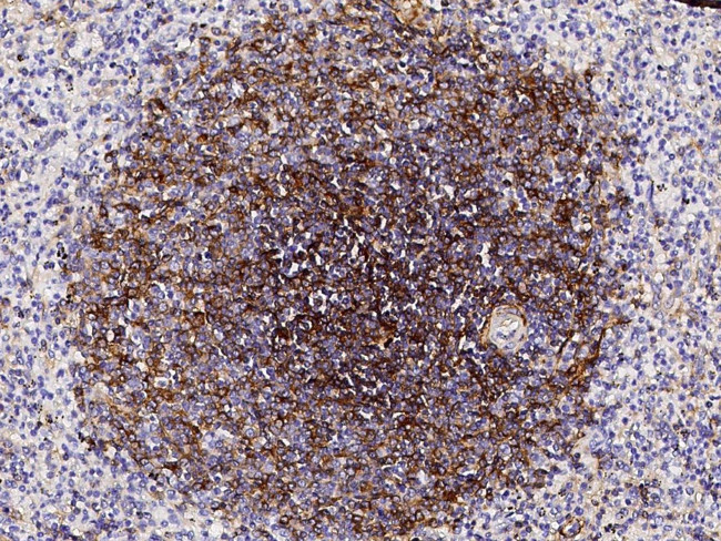 CD73 Antibody in Immunohistochemistry (Paraffin) (IHC (P))