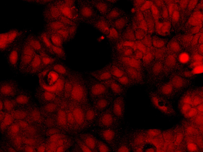 OTUB2 Antibody in Immunocytochemistry (ICC/IF)