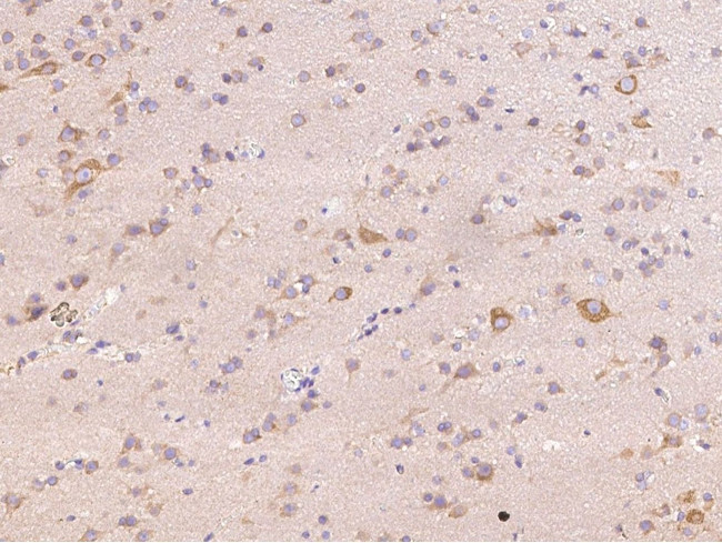 PDGFRB Antibody in Immunohistochemistry (Paraffin) (IHC (P))