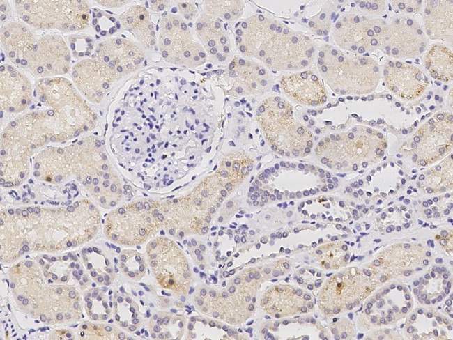 PHYH Antibody in Immunohistochemistry (Paraffin) (IHC (P))
