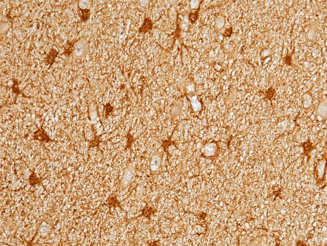 PRDX6 Antibody in Immunohistochemistry (Paraffin) (IHC (P))