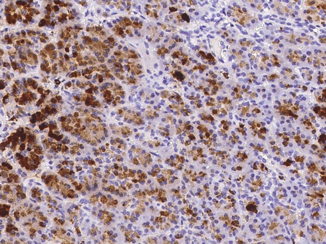 REG1A Antibody in Immunohistochemistry (Paraffin) (IHC (P))