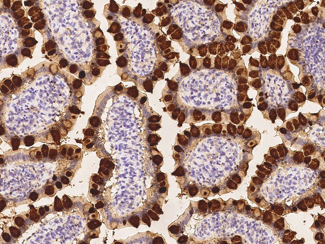 REG4 Antibody in Immunohistochemistry (Paraffin) (IHC (P))