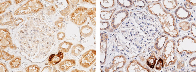 Renin Antibody in Immunohistochemistry (Paraffin) (IHC (P))