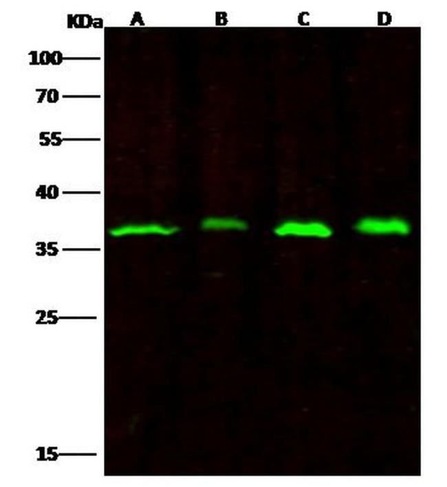 RPRD1B Antibody in Western Blot (WB)
