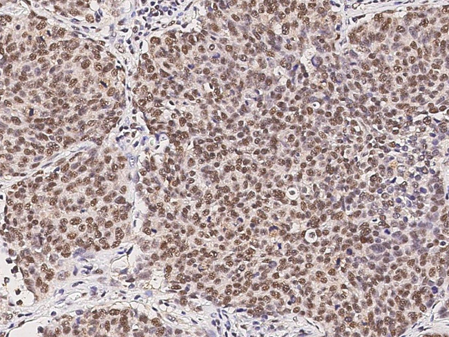 RPRD1B Antibody in Immunohistochemistry (Paraffin) (IHC (P))