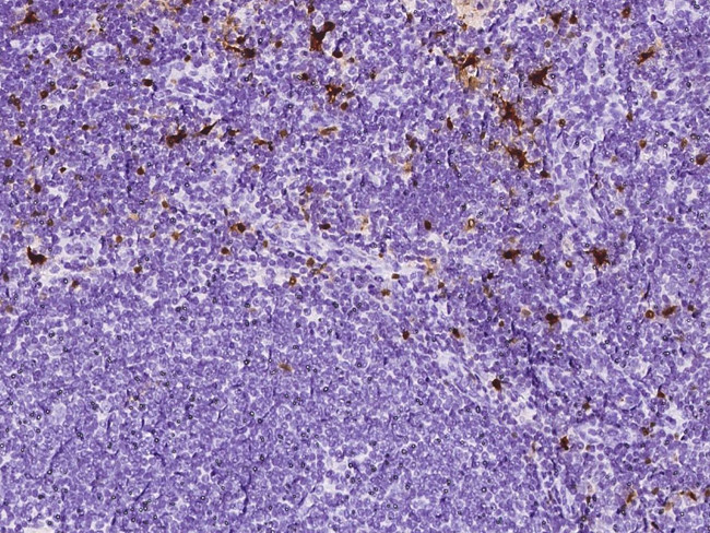 S100B Antibody in Immunohistochemistry (Paraffin) (IHC (P))