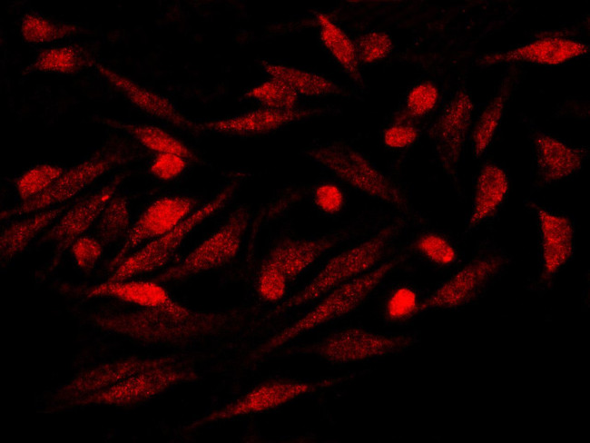 S100P Antibody in Immunocytochemistry (ICC/IF)