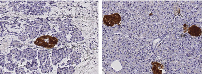 SCGN Antibody in Immunohistochemistry (Paraffin) (IHC (P))