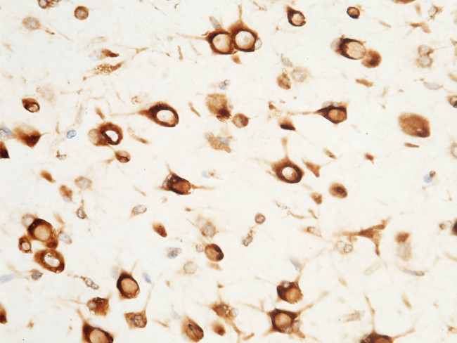 SERPINF2 Antibody in Immunohistochemistry (Paraffin) (IHC (P))