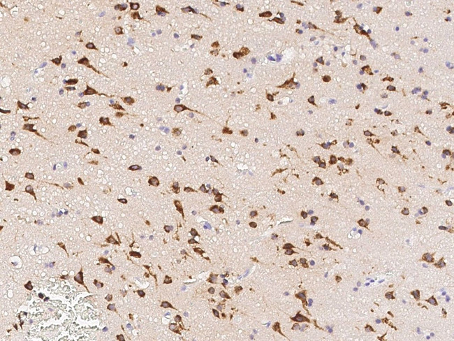 Neuroserpin Antibody in Immunohistochemistry (Paraffin) (IHC (P))