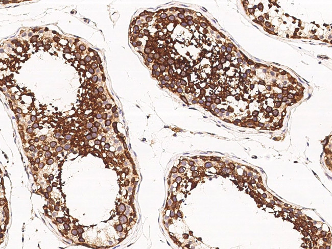 SRPK1 Antibody in Immunohistochemistry (Paraffin) (IHC (P))