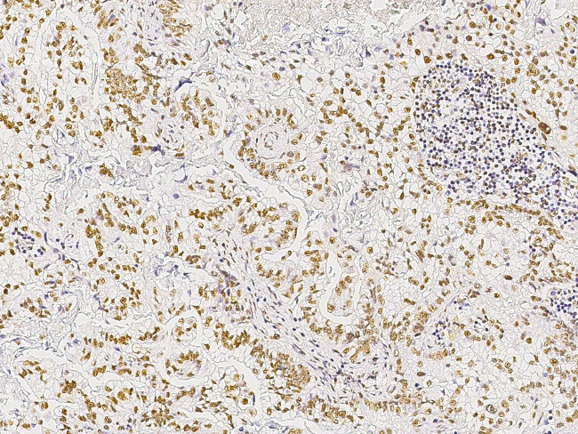 MST1 (STK4) Antibody in Immunohistochemistry (Paraffin) (IHC (P))