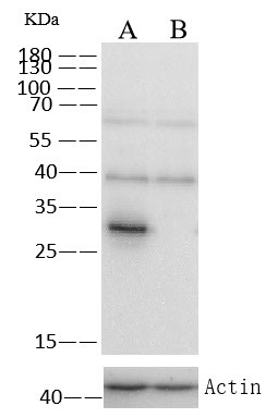 SULT1A1 Antibody in Western Blot (WB)