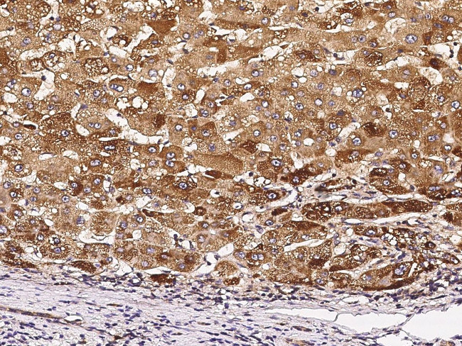 TIE1 Antibody in Immunohistochemistry (Paraffin) (IHC (P))