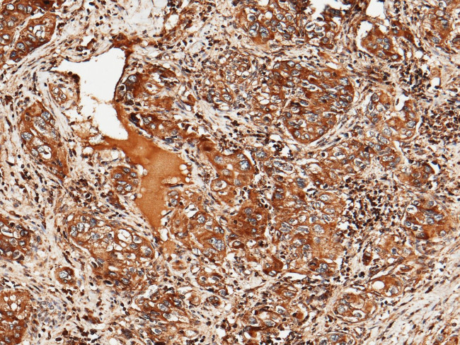 ULBP2 Antibody in Immunohistochemistry (Paraffin) (IHC (P))