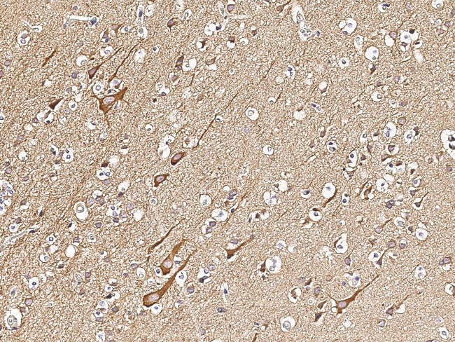 VAPB Antibody in Immunohistochemistry (Paraffin) (IHC (P))