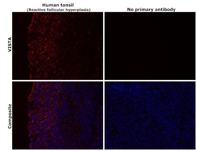 VISTA Antibody in Immunohistochemistry (Paraffin) (IHC (P))
