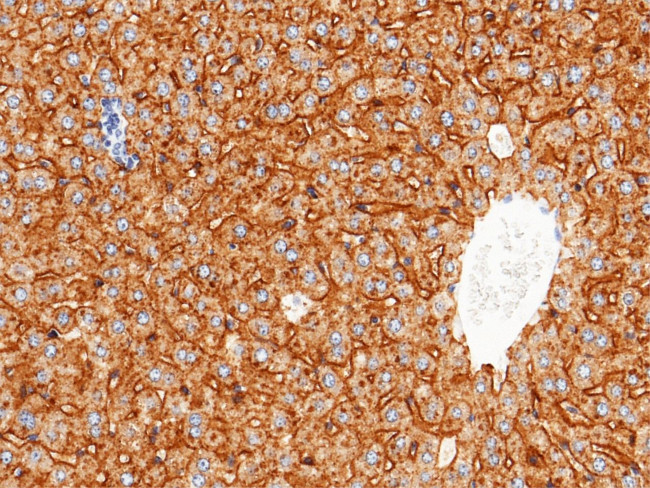 ASGR1 Antibody in Immunohistochemistry (Paraffin) (IHC (P))