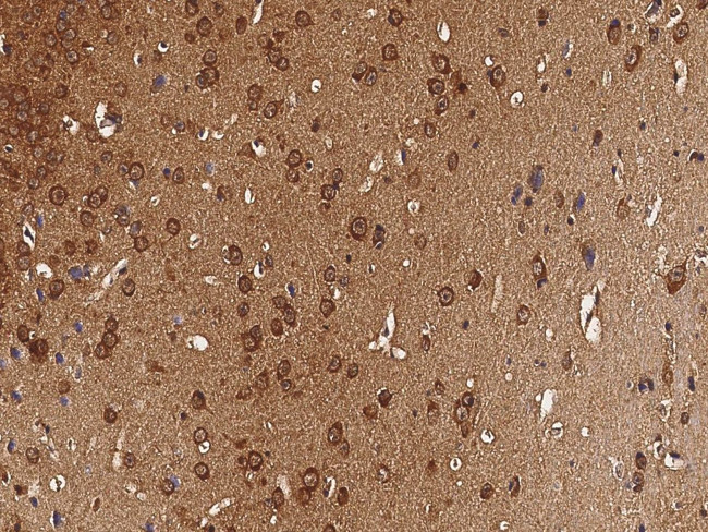 CaMKIV Antibody in Immunohistochemistry (Paraffin) (IHC (P))