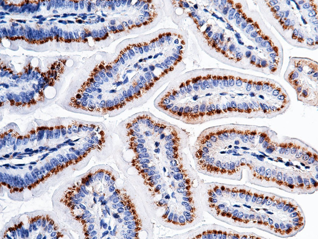 Carbonic Anhydrase XII Antibody in Immunohistochemistry (Paraffin) (IHC (P))