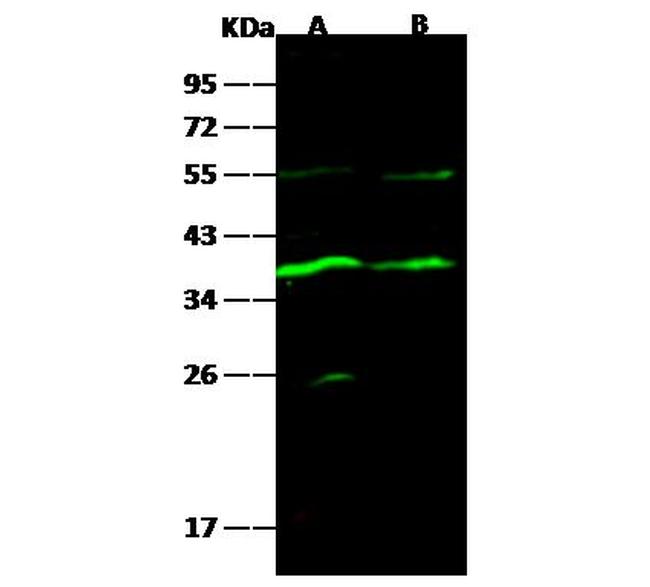 Carbonic Anhydrase VIII Antibody in Western Blot (WB)