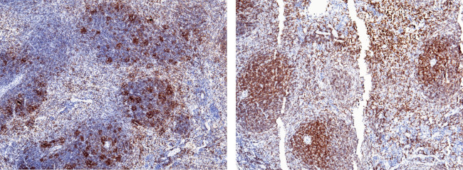 CD2 Antibody in Immunohistochemistry (Paraffin) (IHC (P))