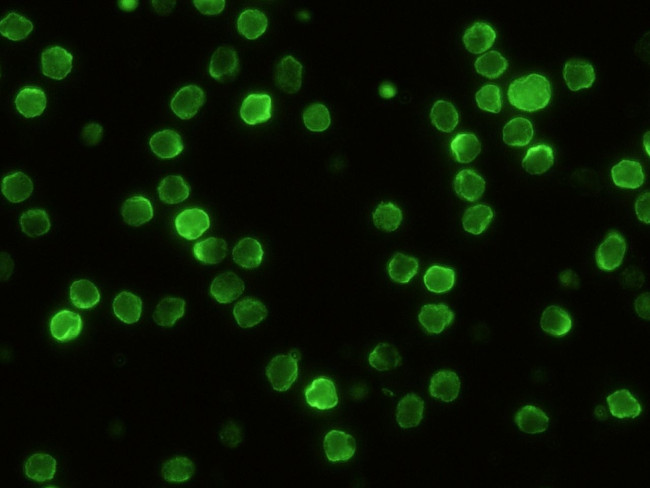 CD229 Antibody in Immunocytochemistry (ICC/IF)