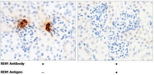 Renin Antibody in Immunohistochemistry (Paraffin) (IHC (P))