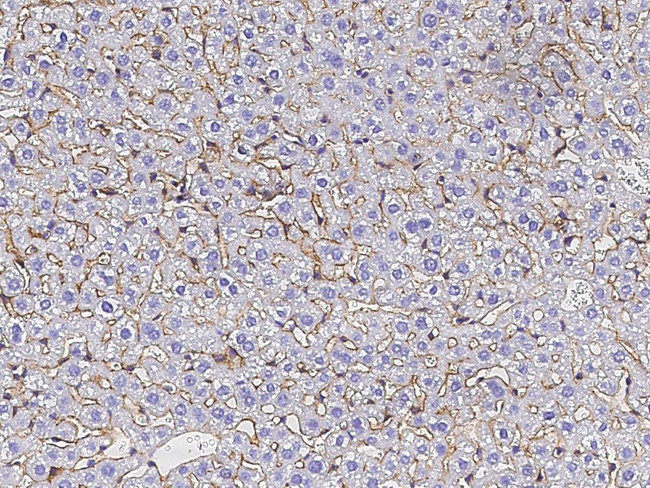 SERPINF2 Antibody in Immunohistochemistry (Paraffin) (IHC (P))