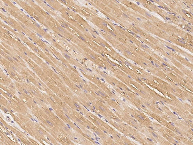 IGFBP2 Antibody in Immunohistochemistry (Paraffin) (IHC (P))