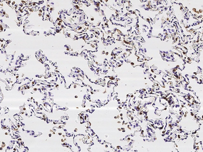 SFTPD Antibody in Immunohistochemistry (Paraffin) (IHC (P))
