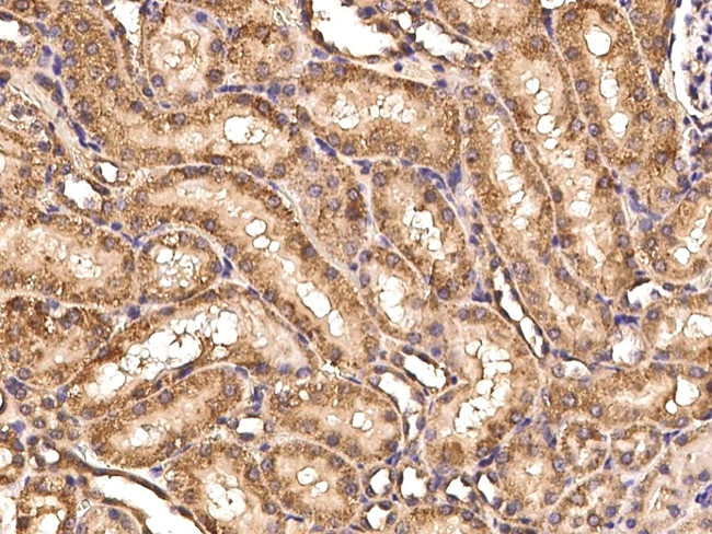 CD297 Antibody in Immunohistochemistry (Paraffin) (IHC (P))