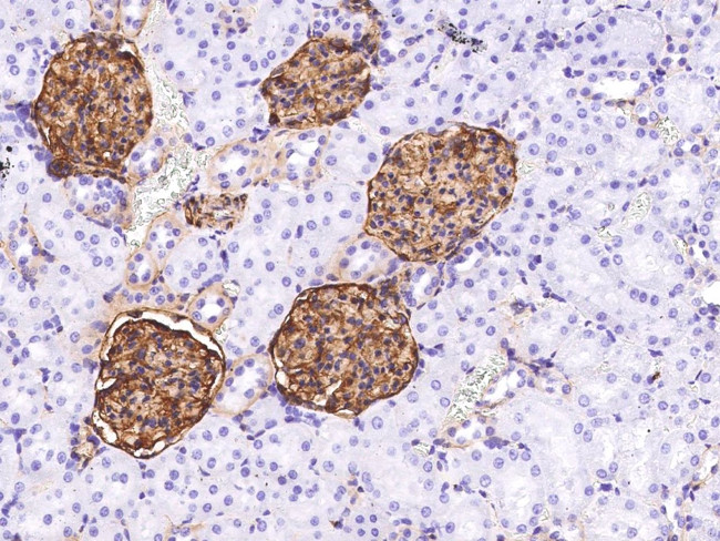 BCAM Antibody in Immunohistochemistry (Paraffin) (IHC (P))