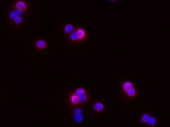ICAM-1 Antibody in Immunocytochemistry (ICC/IF)