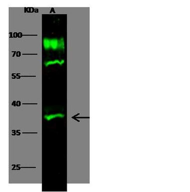 IL20RB Antibody in Western Blot (WB)